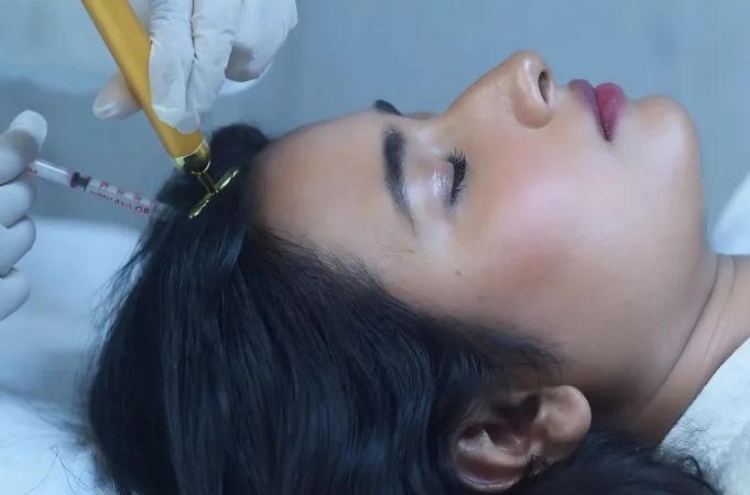 PRP and GFC Therapy